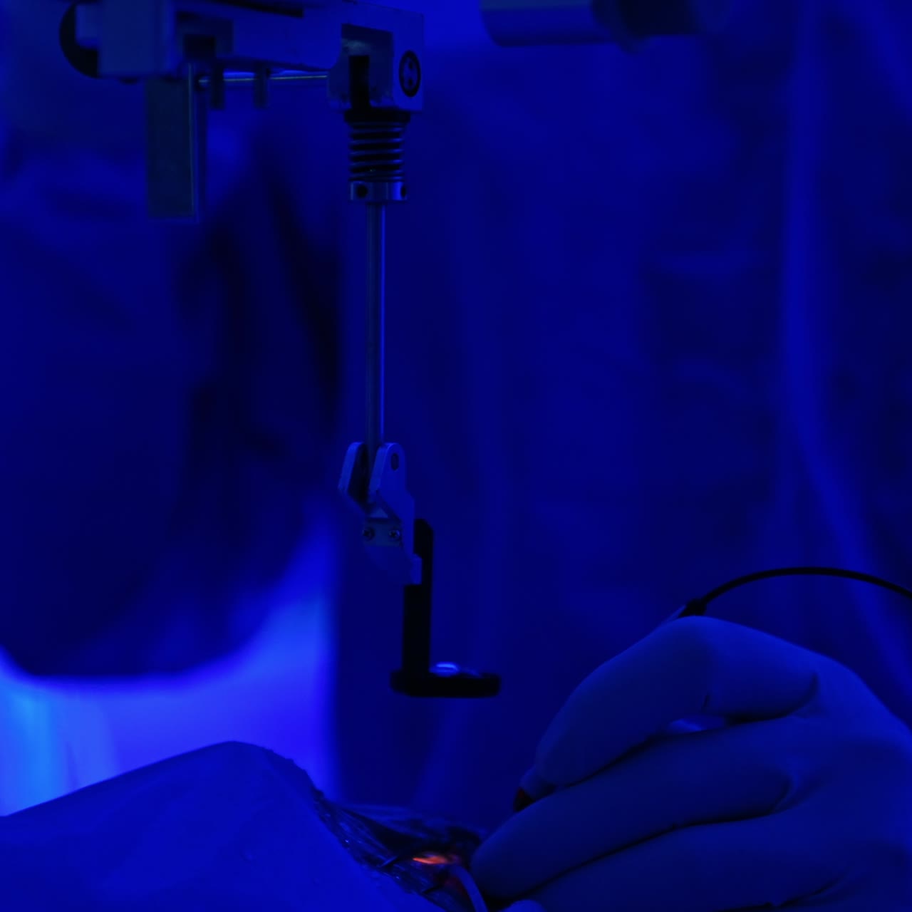 Operazione all'occhio in una stanza con luce blu soffusa. Primo piano. Concetto di chirurgia oftalmica.