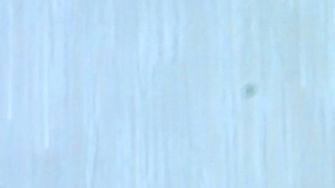 Active sperm under the microscope in the laboratory