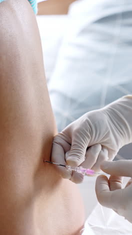 gloved hands of a doctor giving epidural anesthesia to a patient's back. preparation for the child birth. vertical video