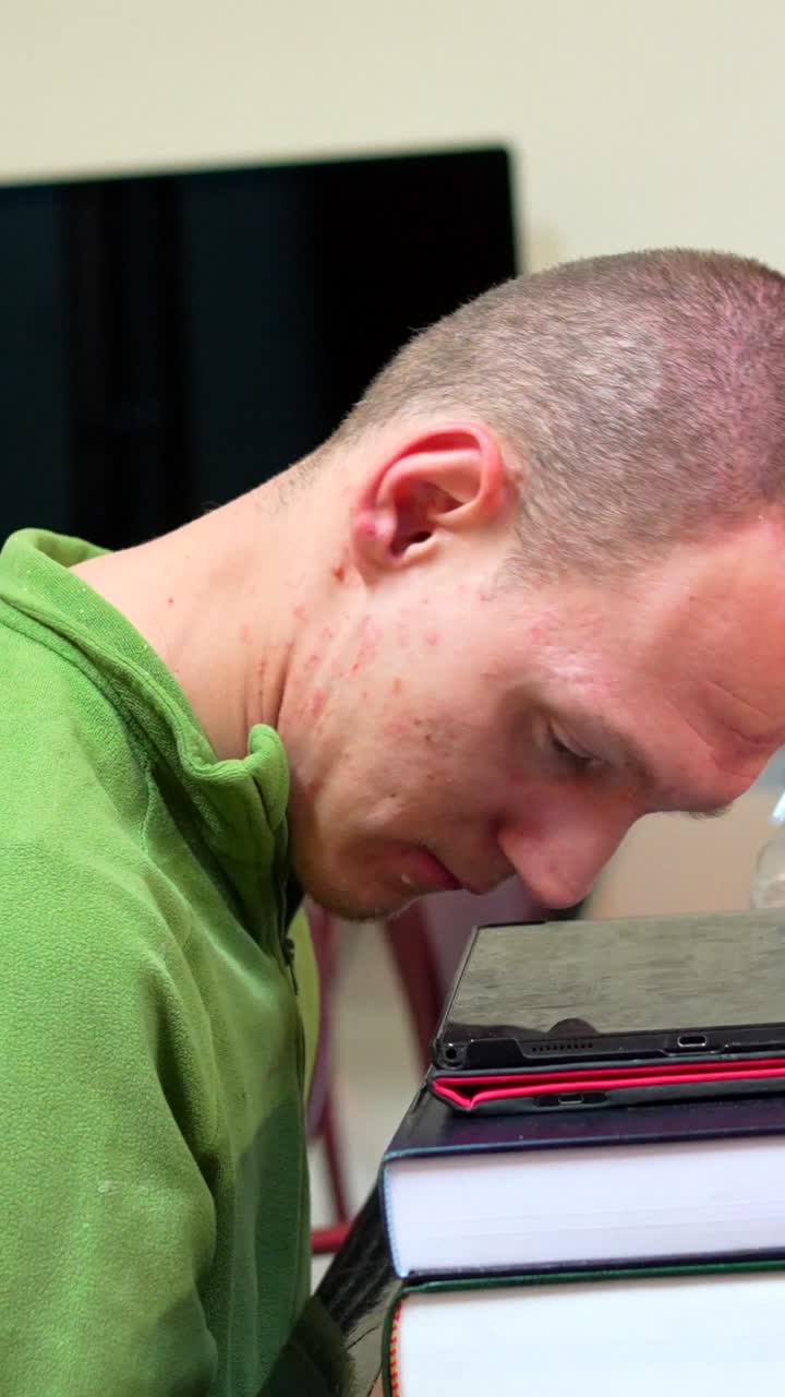 Close-up of a man with acne looking at a laptop on top of books