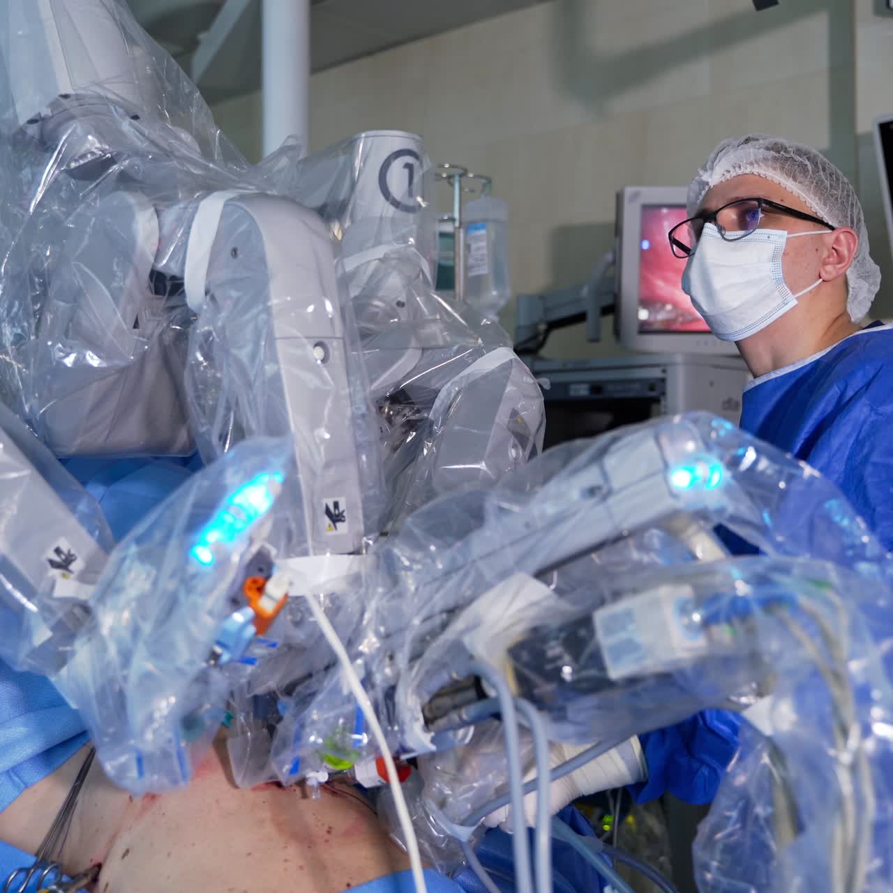 Surgical operation carried out with the help of innovative equipment. Da Vinci robotic equipment helping the surgeon at work