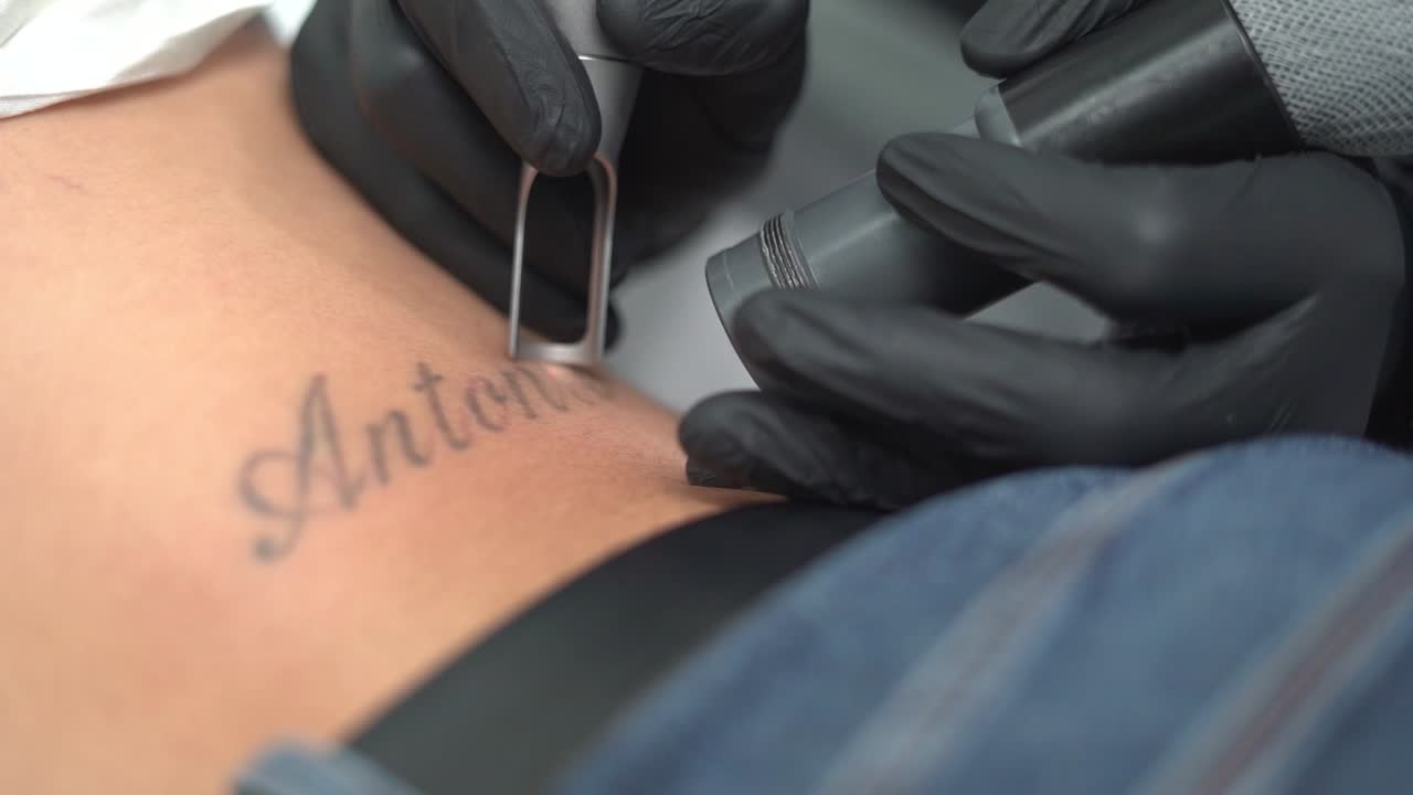 여성의 문신을 제거하거나 삭제하거나 지우십시오.