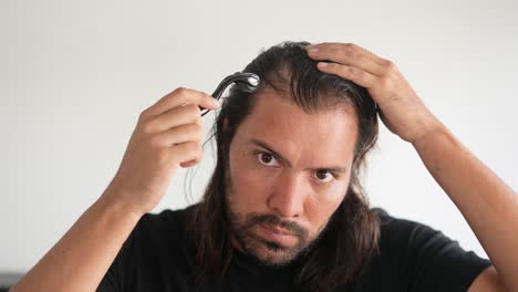 man wearing roller hair on his head to prevent baldness,minoxidil