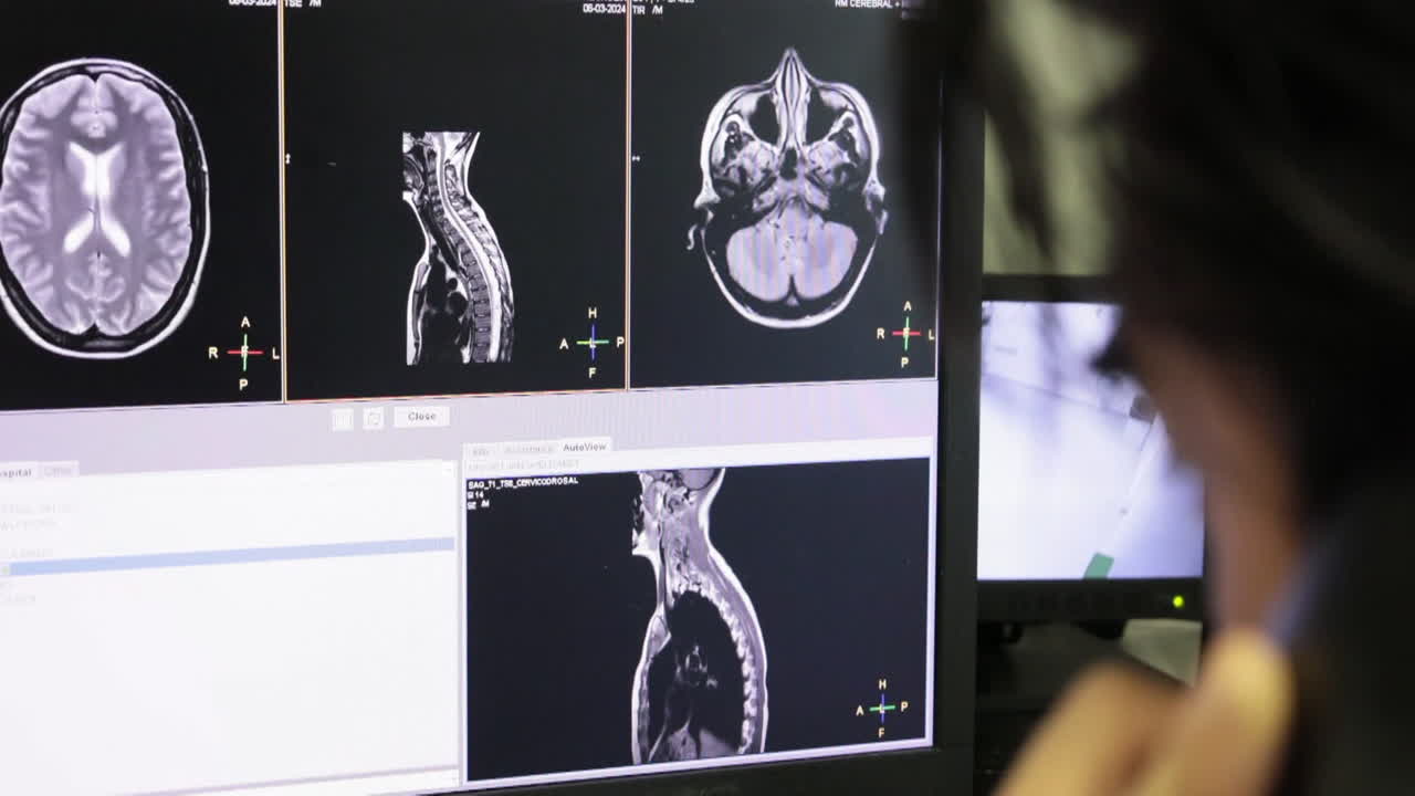MRI Scans on Computer Monitor