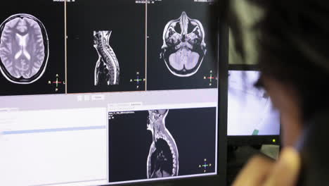 mri scans on computer monitor