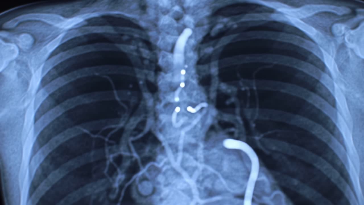 High-resolution imaging reveals chest anatomy, focusing on the intricate network of arteries and vital structures. This examination provides clarity on cardiovascular health and disease.
