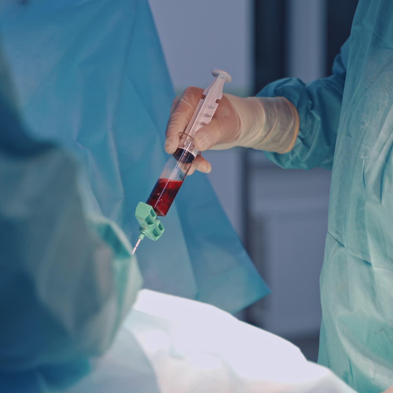 Stem cell treatment. Platelet rich plasma-PRP. Biological therapies.