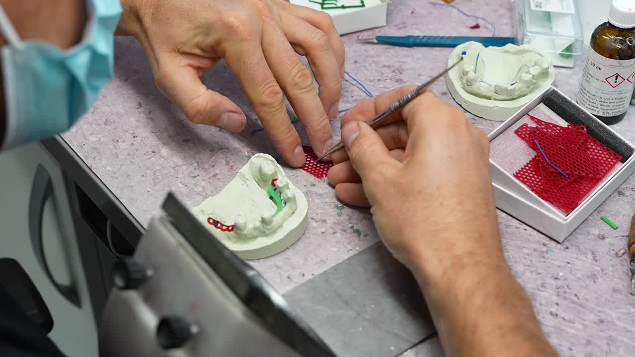 técnico dental masculino preparando andamios para implantes dentales con bisturí en el puesto de trabajo de una pequeña clínica dental