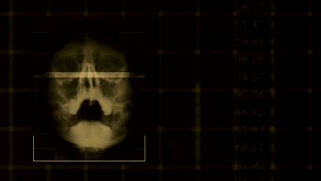 scan of a human skull, looped brown hud interface medical equipment