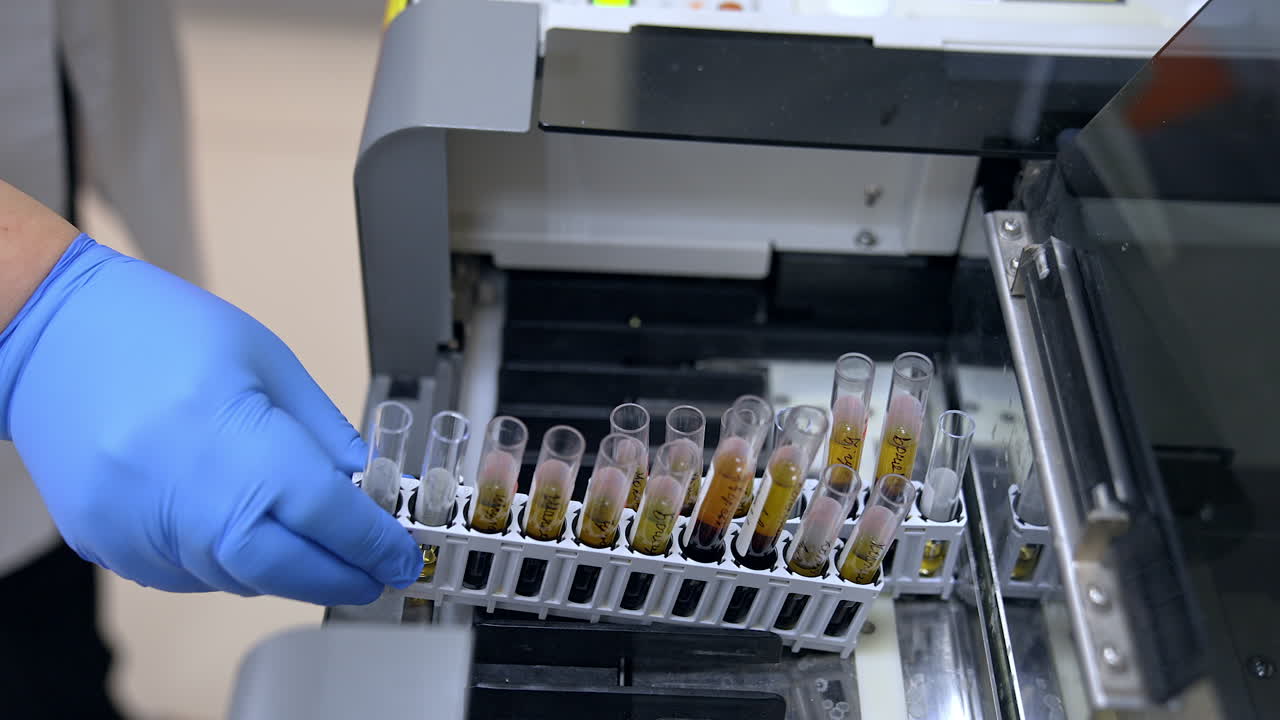 Placing the sets of test tubes into the modern apparatus. Close up. Laboratory science analysis in present day clinics.
