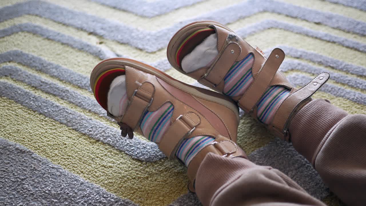 어린이 뇌성마비 장애, 다리 정형