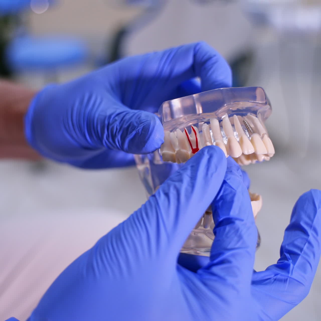 Jaw model in dentist's hands. Dental implant laboratory. Artificial teeth in hands of stomatologist in hospital. Close-up