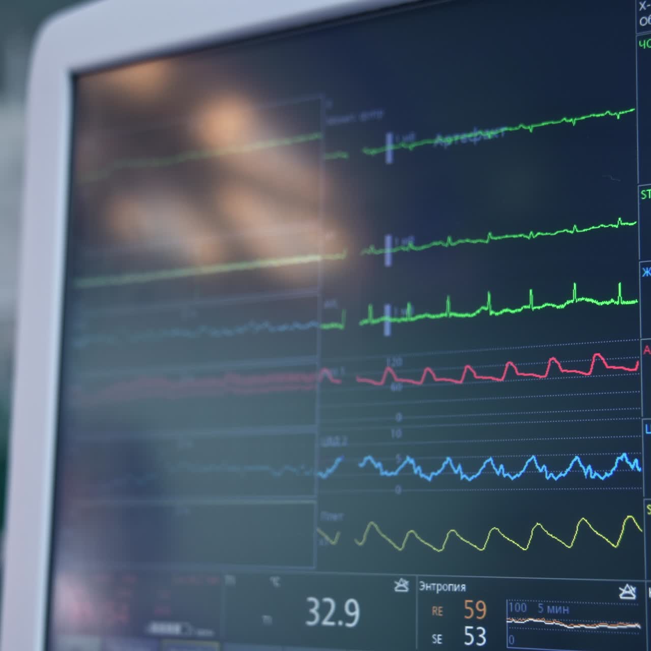 Lines and digits of different colors changing on the screen of equipment. Lung ventilation machine working at operation. Close up