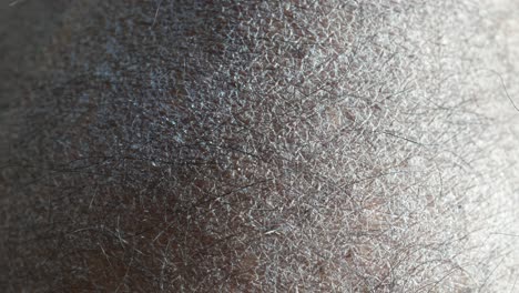 acercamiento de la textura de la piel seca