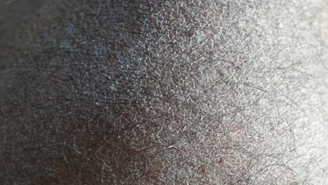 close up of dry skin texture