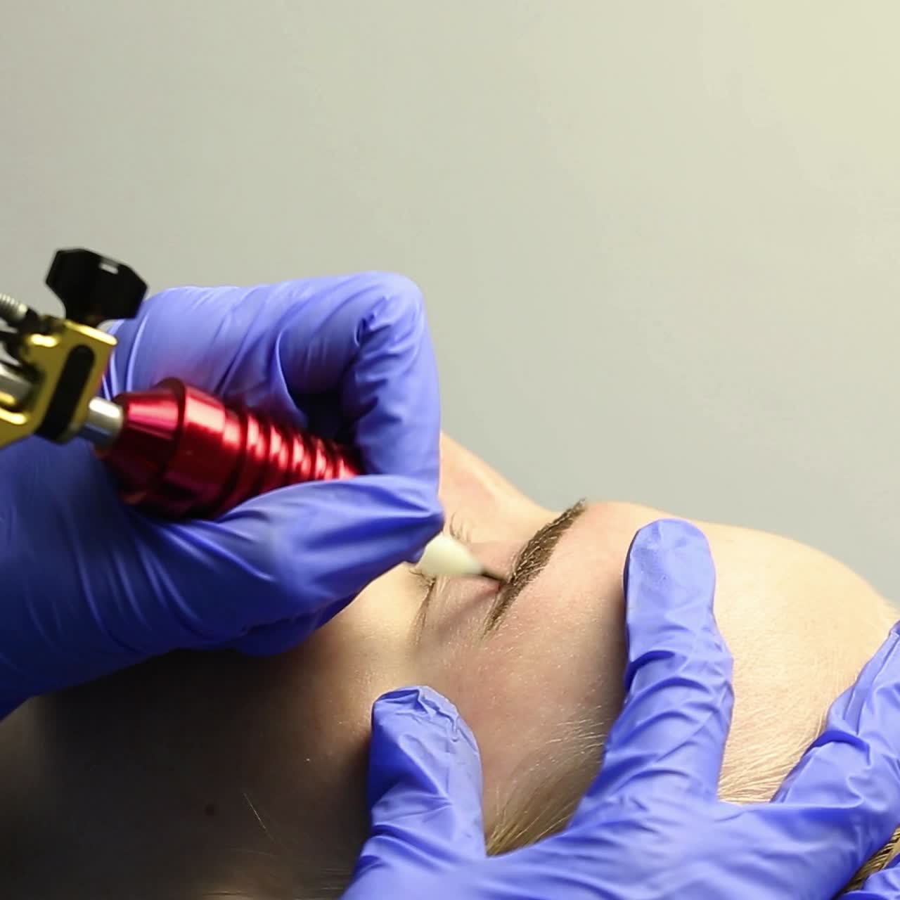 Correction of eyebrows