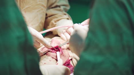 doctor wearing protective clothing performing surgery using sterilised equipment. surgery and emergency concept