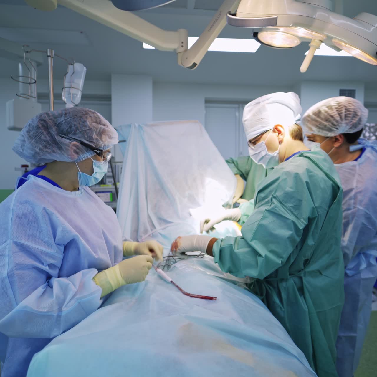 Cooperating team of surgeons performing operation. Female nurse assisting the doctors and arranging instruments