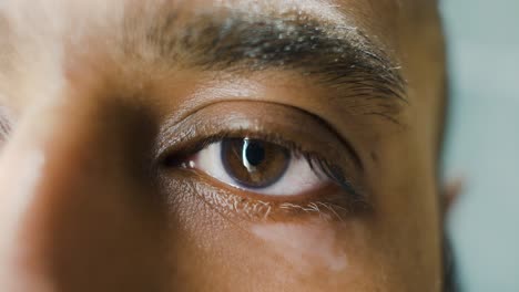 close up of vitiligo on left eye lid on south east asian man