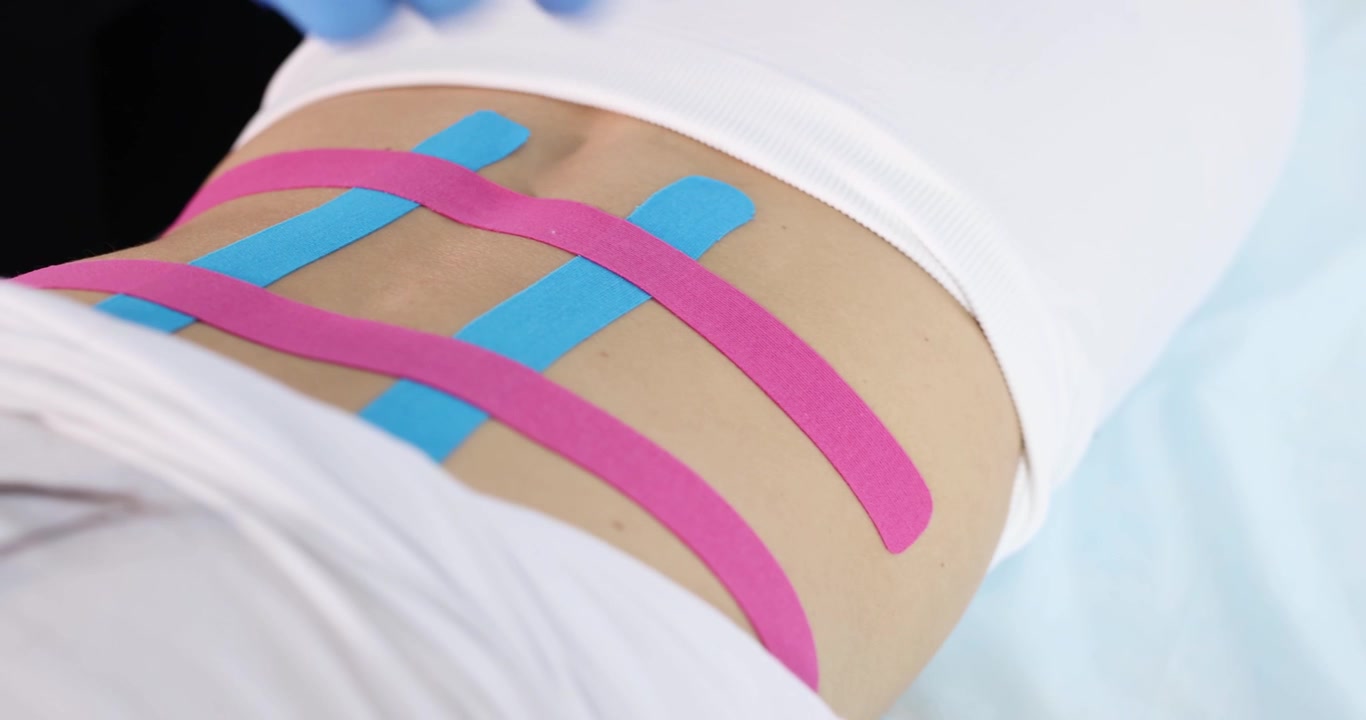 Il medico applica strisce di nastro kinesiologico sulla parte bassa della schiena del paziente.