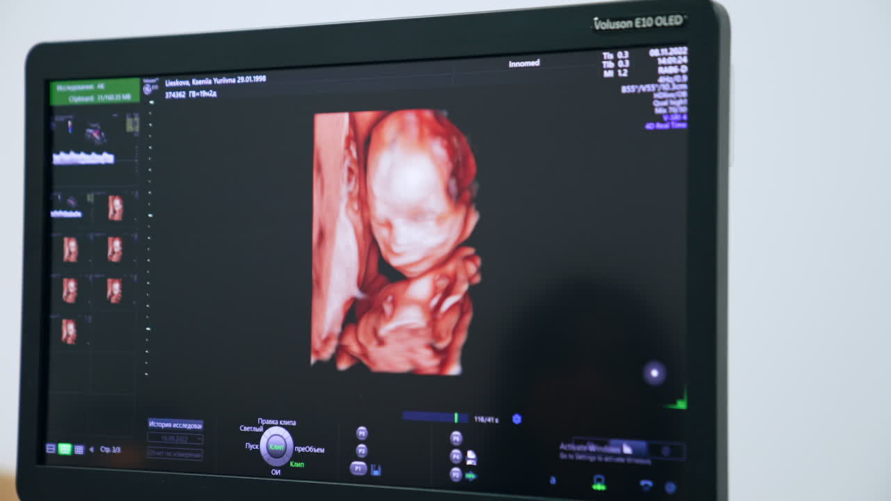 Image of a child in mom's womb on the monitor of ultrasound machine. Checking the baby development on the ultrasonic equipment. Close up.