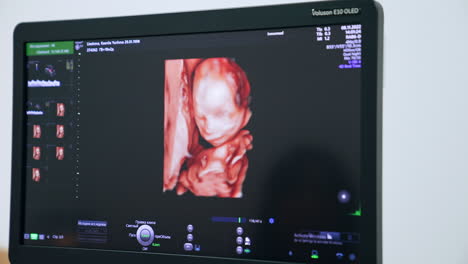 image of a child in mom's womb on the monitor of ultrasound machine. checking the baby development on the ultrasonic equipment. close up.