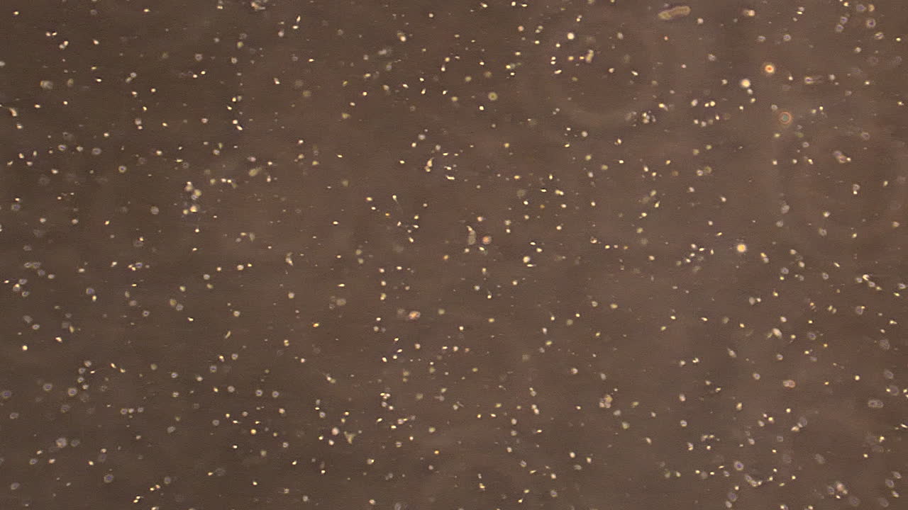 단계 대조 조명에서 미세한 정자 세포를 가로질러  ⁇