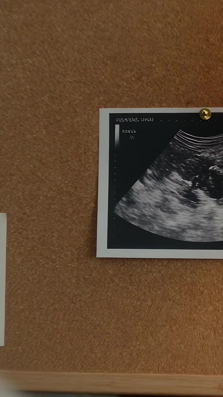 Video verticale: Donna in maglione che si gira in clinica, effettuando una ripresa con panoramica su un'ecografia appuntata con una spilla d'oro su un pannello di sughero.