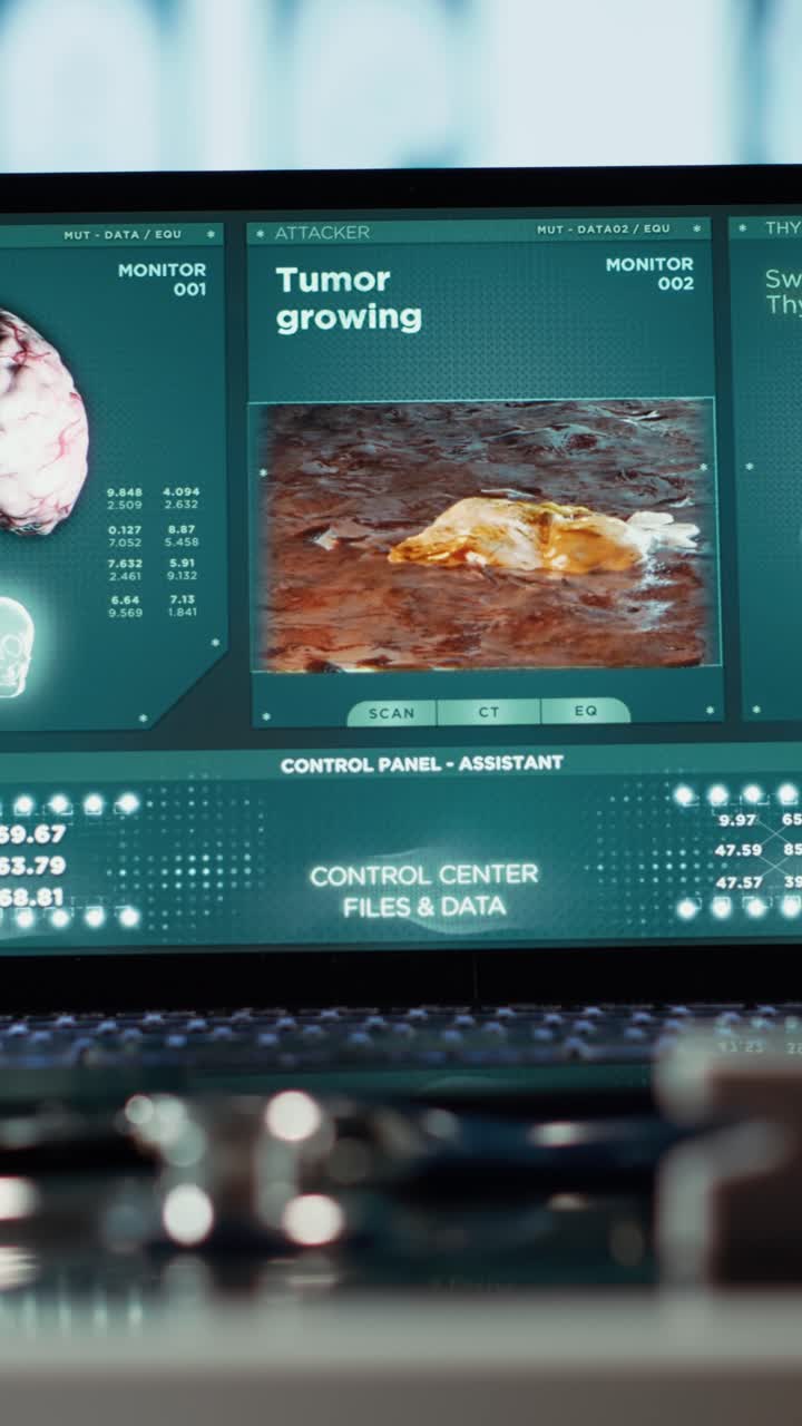 Close-up of Laptop Displaying Medical Tumor Growth Data