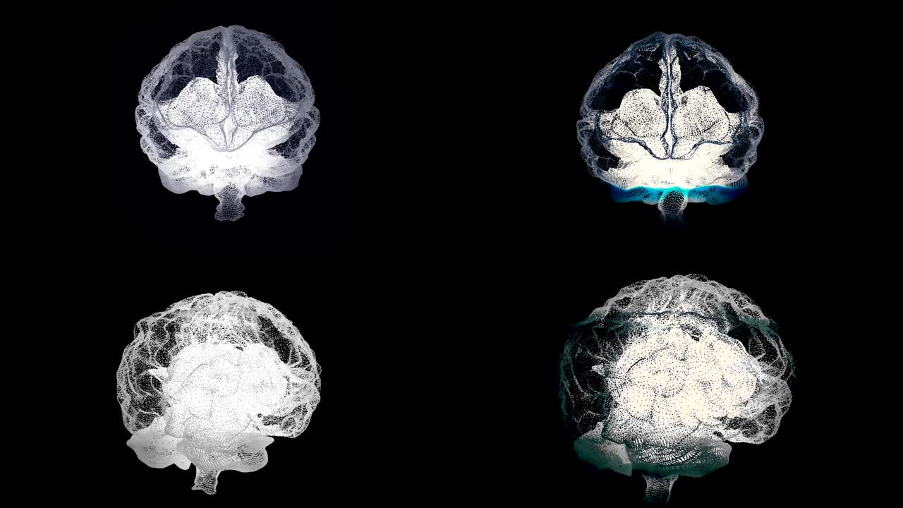 Four brains spinning with mri scanning on black background, health concept. Animation. Human brain, right and left hemispheres during medical procedure, seamless loop