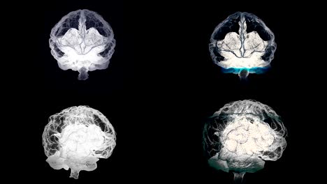 four brains spinning with mri scanning on black background, health concept. animation. human brain, right and left hemispheres during medical procedure, seamless loop