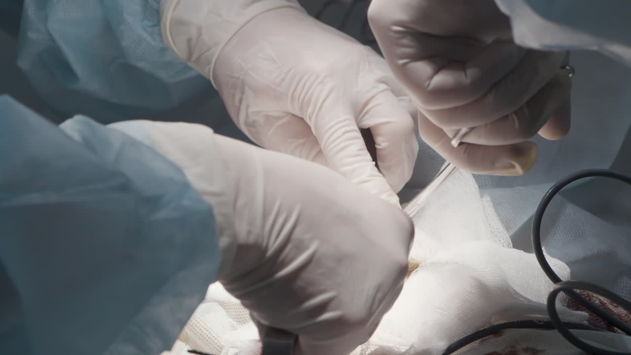 procedimiento quirúrgico