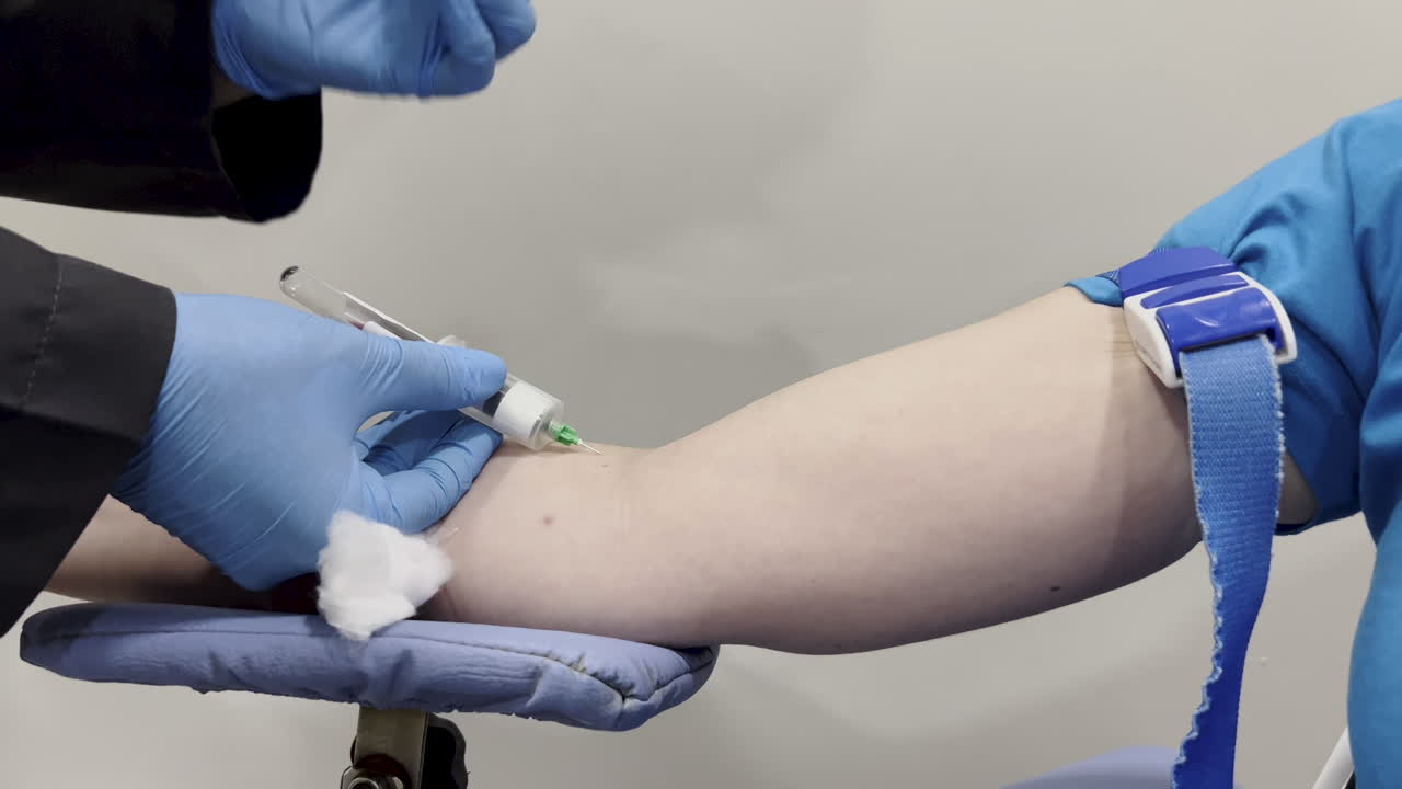 Close shot of a woman's arm and a nurse's hands changing the blood test collection vial