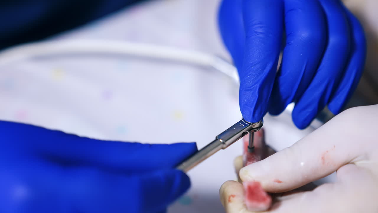Hands in latex gloves tighten the screw with metal tool. Close up. Dentistry course in medical school.