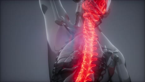 Rückenschmerzen-In-Den-Hinteren-Knochen