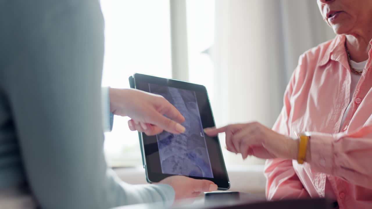 médico, mujer anciana y pastilla para rayos x