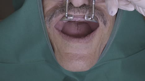 dental procedure: close-up of a patient's mouth during a dental examination