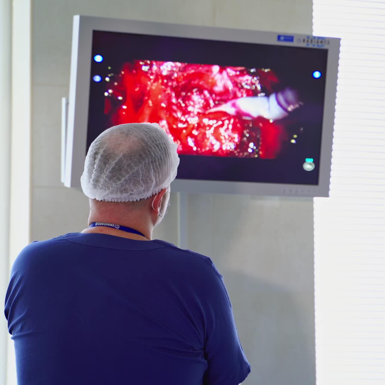 Advanced robotic surgery machine at hospital. Medical inovation 3D view endoscopy for robot surgery