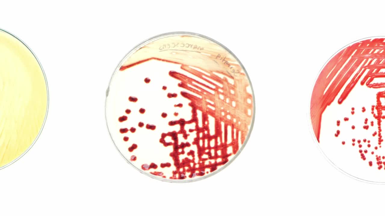 Top view closeup panning scene on colony of bacteria on nutrient media in petri dish, experiment of microbial culture in microbiology science laboratory