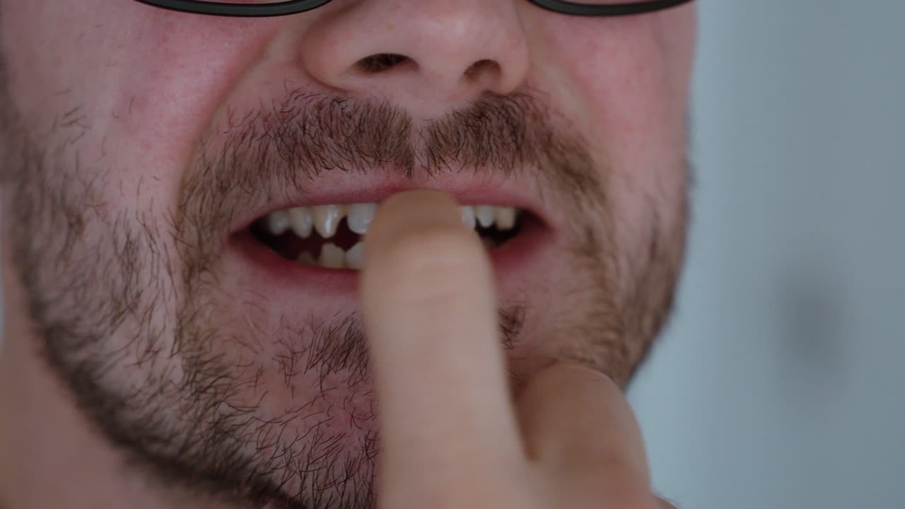 Nahaufnahme eines Mannes, der an seinen Fingernägeln kaut, Ausdruck von Nervosität und Angst. Konzept von Stress, schlechten Angewohnheiten, mentaler Anspannung und ungesundem Bewältigungsverhalten