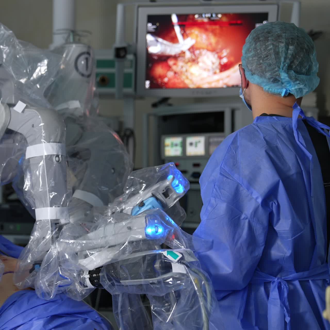 Modern robotic equipment operating the patient. Doctor watches the surgery at the screen