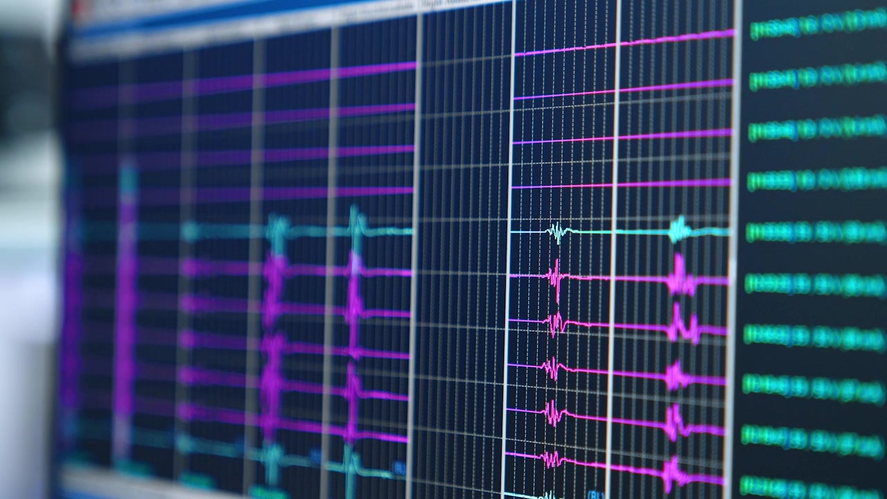 Close-up of Real-time Medical Data Waveforms on a Monitor Screen