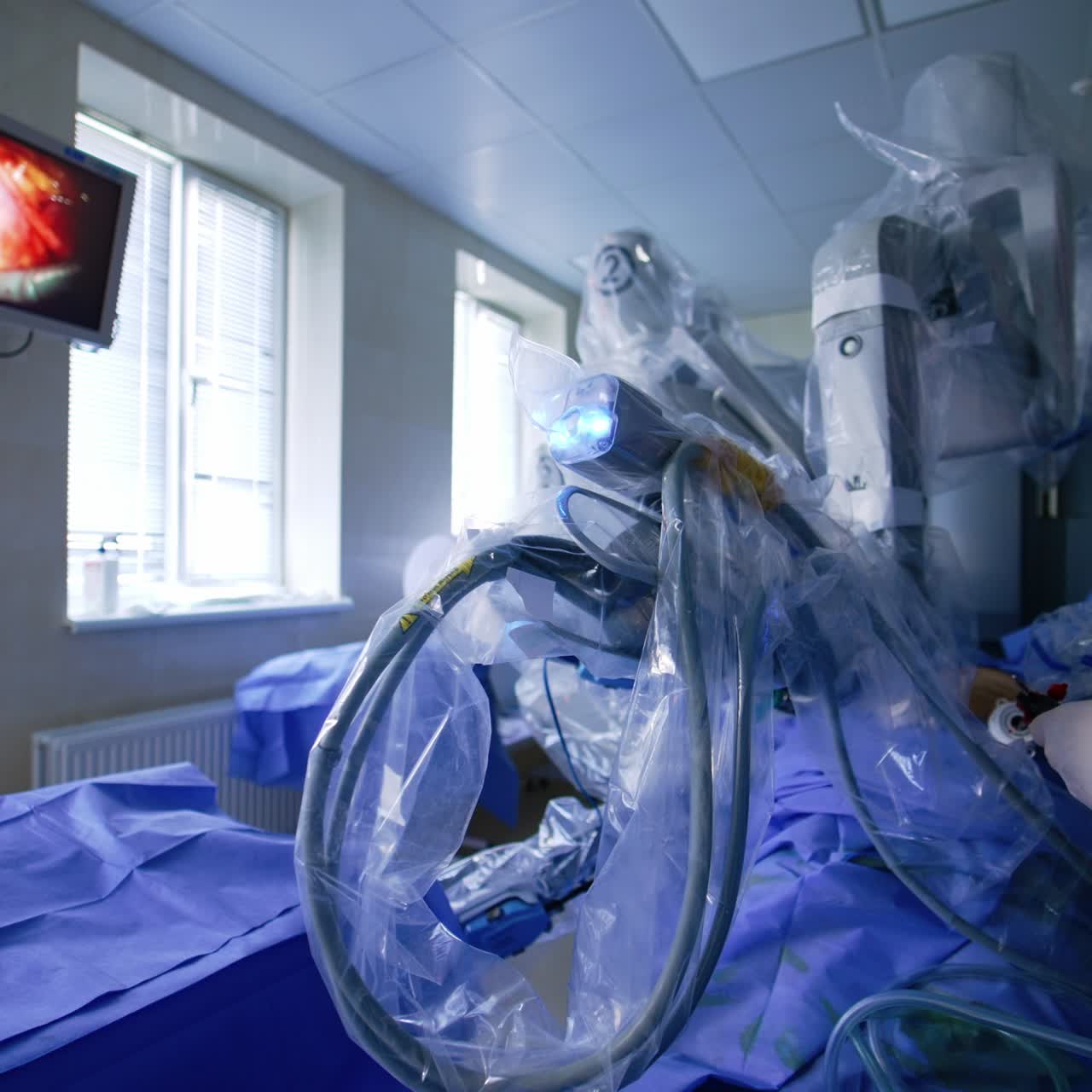 Futuristic robotic equipment performing minimally invasive operation. Hand of male doctor puts out the instrument from patient's body