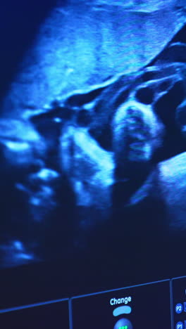 blue monitor showing the baby movement in mother's belly. close up. ultrasound examination of a pregnancy. vertical video
