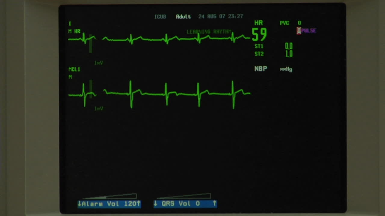 정상적인 심전도가 화면에 나타납니다.