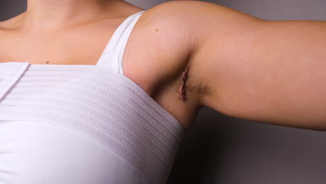 woman lifting hand slowly and showing armpit scar post breast augmentation