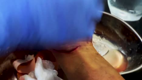 tratamiento de limpieza de heridas abiertas