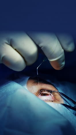 modern eye healthcare surgery. cataract professional operating. vertical video