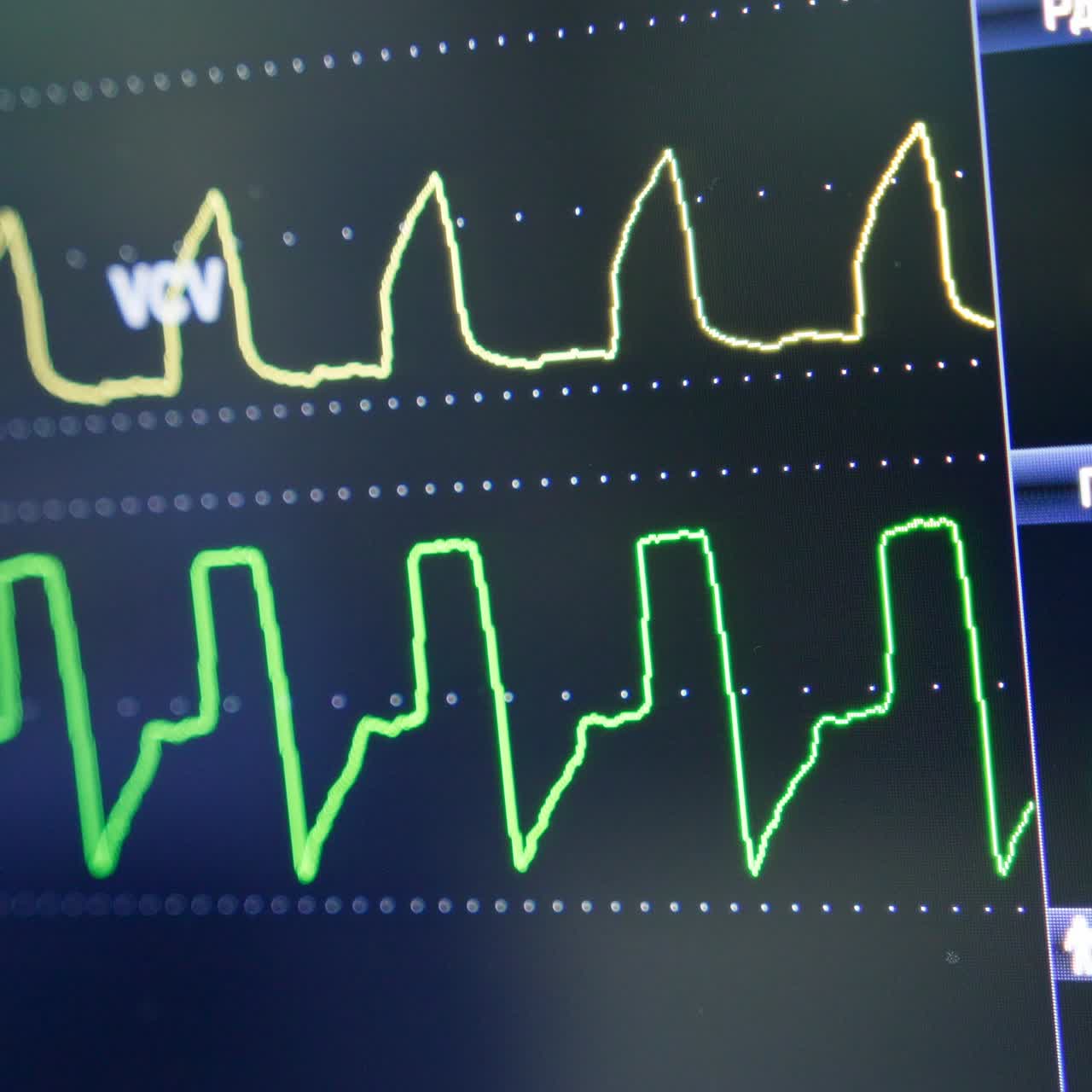 Observation of patient's life signs at the screen of a machine. Curved lines changing on the black monitor. Close up