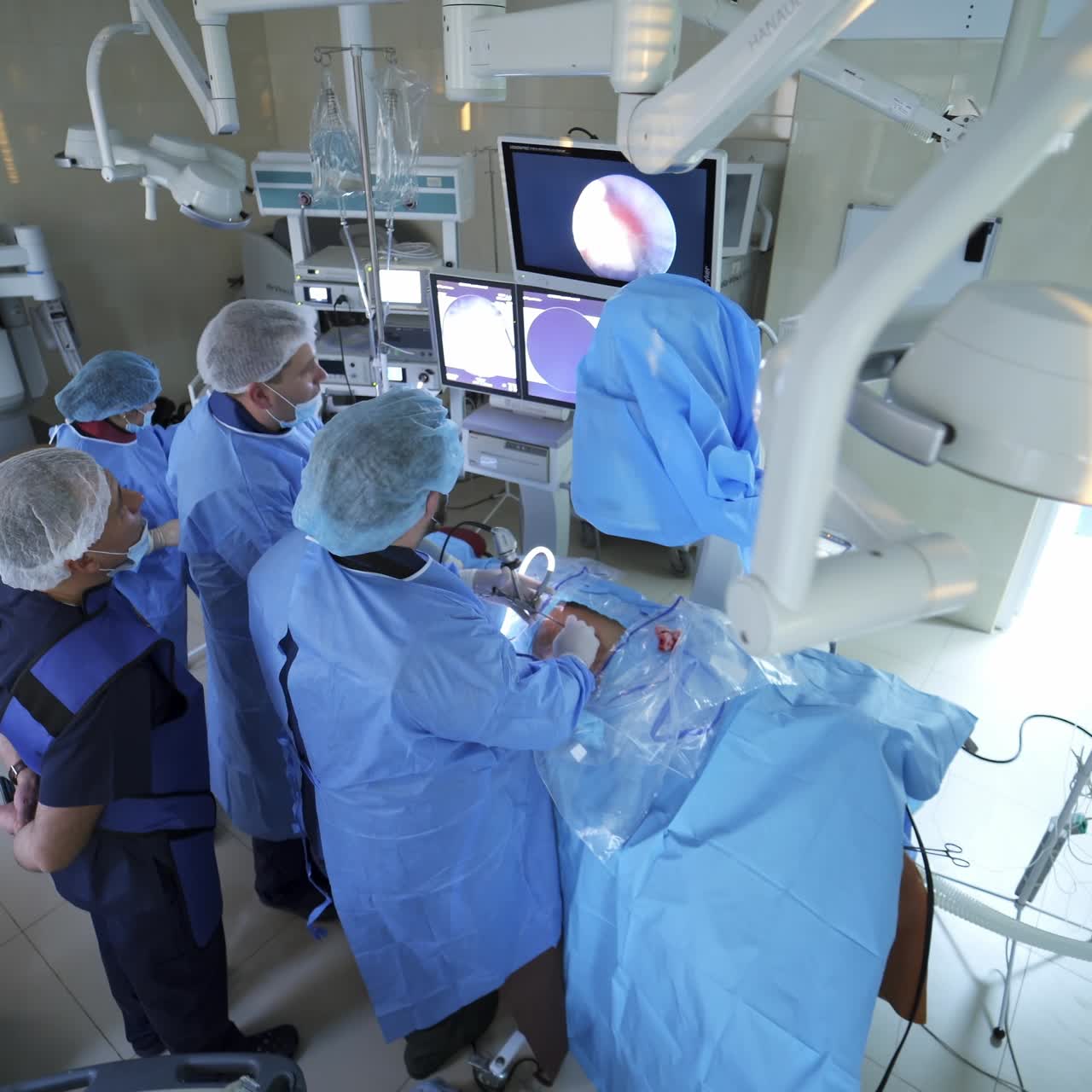 Handsome doctor surgeon working with team. Operating ward full of surgeons